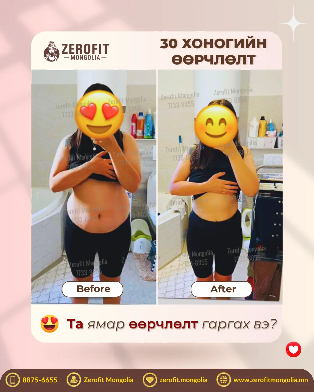 100