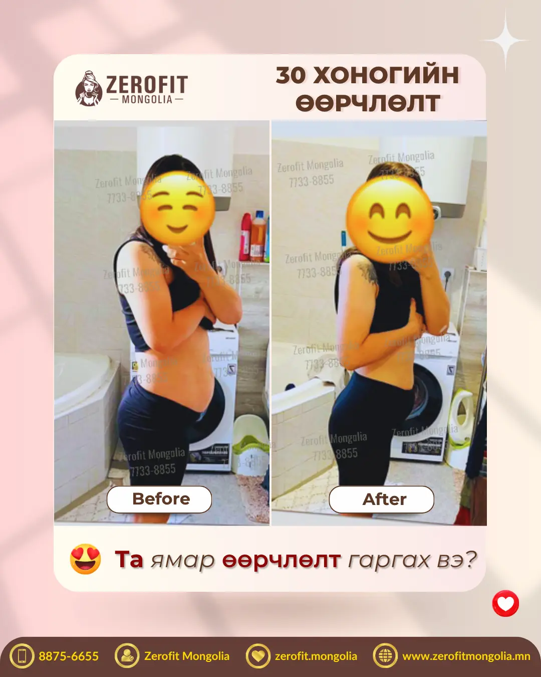 101